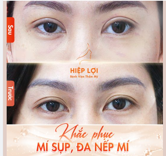 Hình ảnh thực tế sau 2 tuần của khách nhà Hiệp Lợi