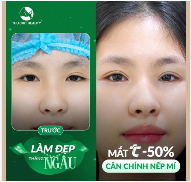 Đỉnh nóc, kịch trần, bay phấp phới là Mắt TC chỉ từ 3.9Tr