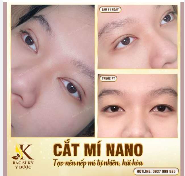 CẮT MÍ NANO BAO LÂU THÌ ĐẸP?