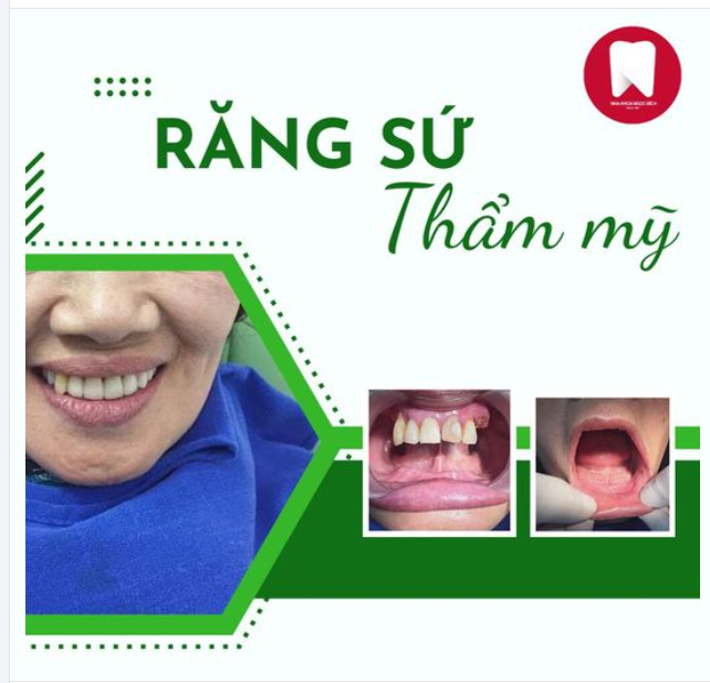MẤT HẾT RĂNG THẬT - PHẢI LÀM SAO?