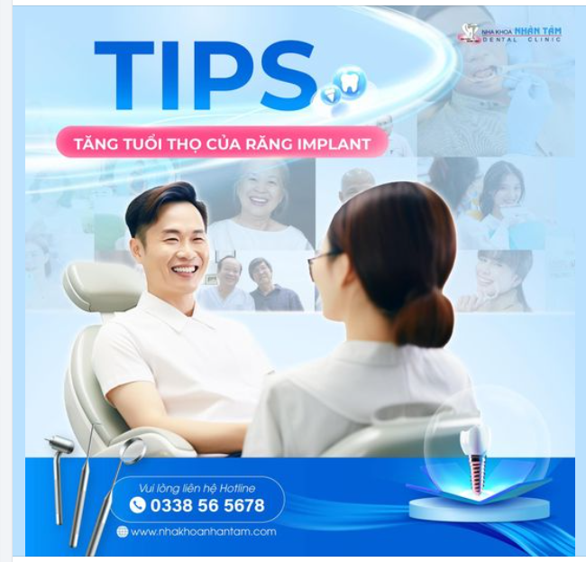 Tips vàng giúp răng Implant bền vững