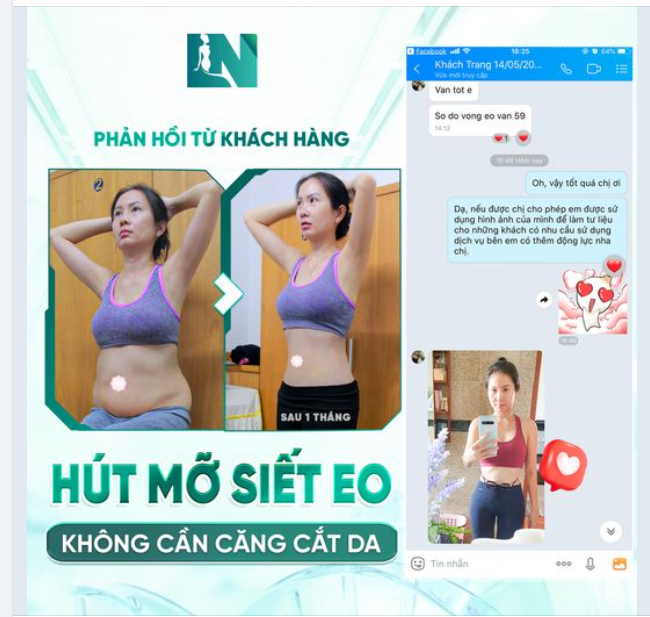 Feedback đầu tuần "nóng hổi" từ bạn khách sau 1 tháng thực hiện hút mỡ bụng không cần phẫu thuật căng cắt da tại ekip Bác sĩ Lương Ngọc