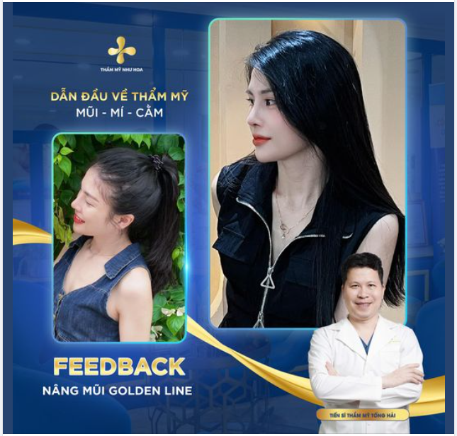 3 tháng sau khi nâng mũi Golden Line, chị đẹp Ngạc Lynh tự tin khoe dáng mũi xinh, đẹp mọi góc.