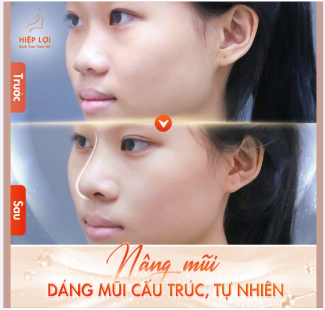 Hình ảnh thực tế sau 10 ngày của khách nhà Hiệp Lợi
