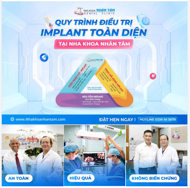 Chăm sóc và bảo tồn răng Implant với quy trình khép kín tại Nha khoa Nhân Tâm
