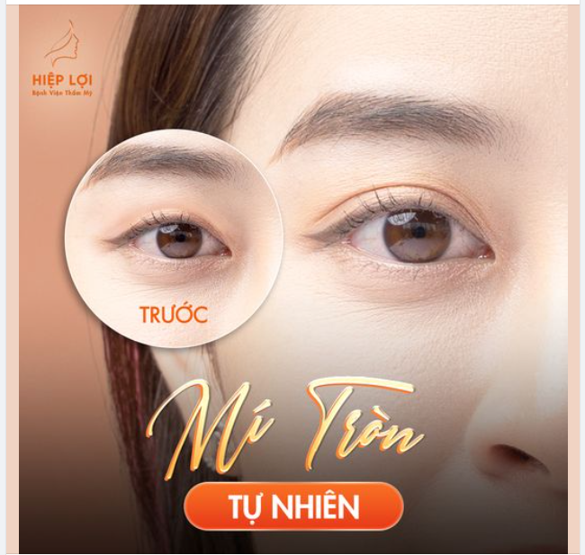Thời điểm hoàn hảo để có đôi mắt đẹp kịp đón "Trung thu"