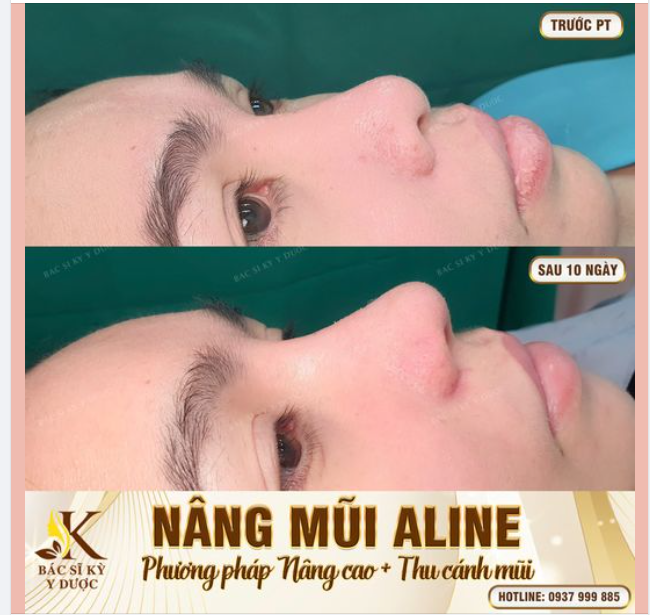 TƯỞNG ĐẸP 9 AI DÈ ĐẸP…10