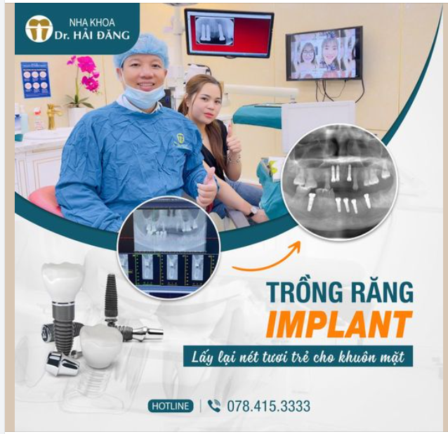 TRỒNG RĂNG IMPLANT - LẤY LẠI NỤ CƯỜI TƯƠI TRẺ CHO KHUÂN MẶT