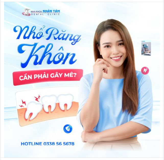 Nhổ Răng Khôn Cần Phải Gây Mê?