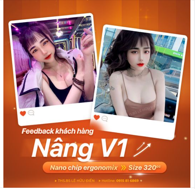 Feedback Nâng V1 sau 3 năm thực hiện: "Đỉnh nóc, kịch trần"