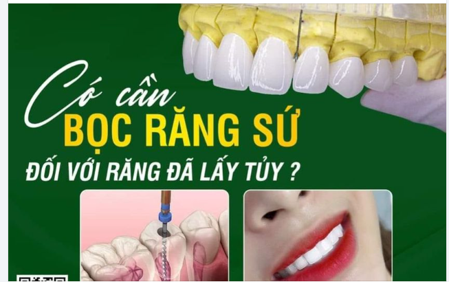 KHÁM PHÁ TUỔI THỌ CỦA RĂNG ĐÃ LẤY TỦY
