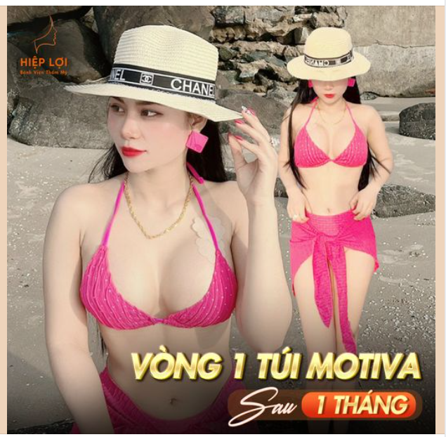 Trước đây, vòng 1 của chị khách khá khiêm tốn, khiến chị mặc cảm và ngại diện những bộ trang phục yêu thích.