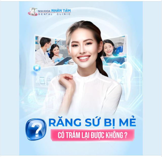 Răng sứ bị mẻ có trám lại được không?