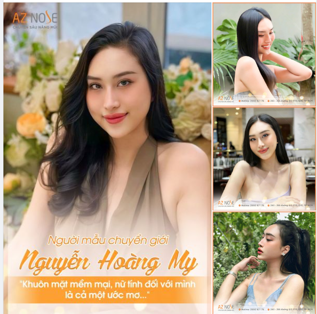 Người mẫu chuyển giới Hoàng My - Từng nâng mũi 2 lần nhưng đều "không thành công"!