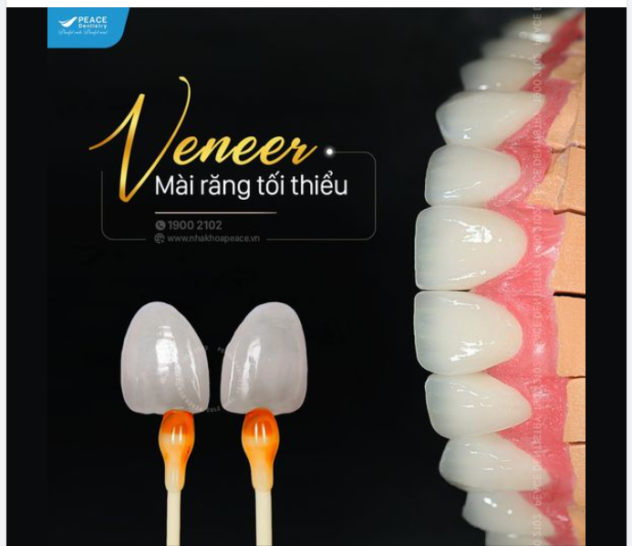 Hãy luôn nhớ: THẨM MỸ RĂNG SỨ CHÍNH LÀ THIẾT KẾ NỤ CƯỜI CHO MỖI CÁ NHÂN