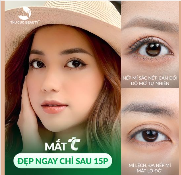 Đây có phải nếp mí mà nhiều chị em vẫn ao ước