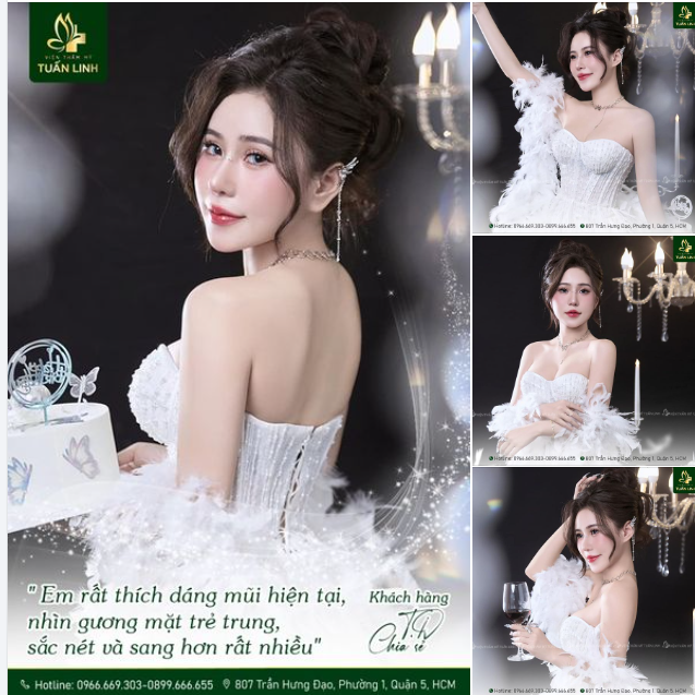 Chọn nâng mũi để ''nâng cấp'' diện mạo T.D đã cực kỳ hài lòng với nhan sắc hiện tại!