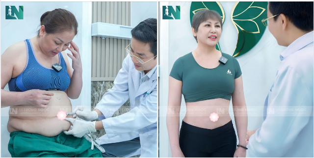 Hãy cùng dự đoán số CM vòng bụng chị Hà đã giảm được tại đây Bác sĩ sẽ tặng ngay ưu đãi 30% chi phí hút mỡ cho ai dự đoán nhanh nhất và chính xác nhất!