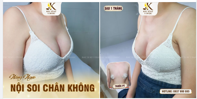TẠM BIỆT TƯỜNG PHẲNG - CHÀO ĐÓN "NÚI ĐÔI"