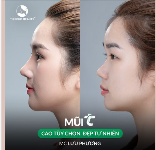 Rinh ngay mũi xinh chỉ từ 9.9Tr Ưu đãi duy nhất 30-31/9