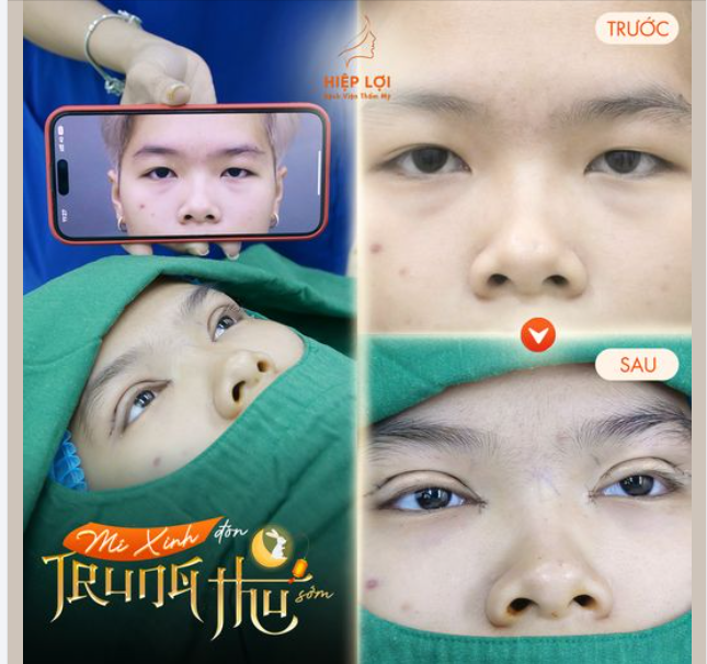 Tạm biệt "MÍ LÓT, MÍ SỤP" đón "Trung thu" - Chỉ sau 45 phút