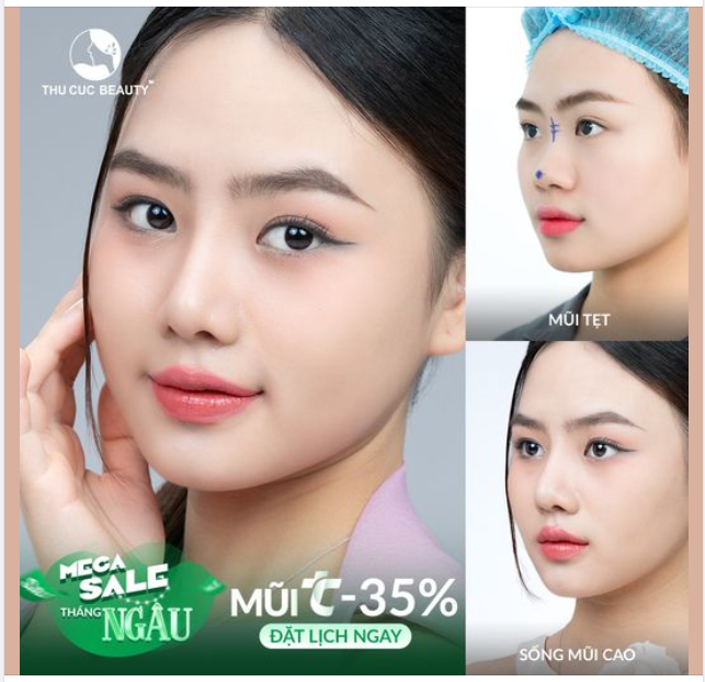 Không còn tự ti vì sống mũi thấp. Nâng mũi ngay hôm nay để hưởng ưu đãi Mũi TC -35%