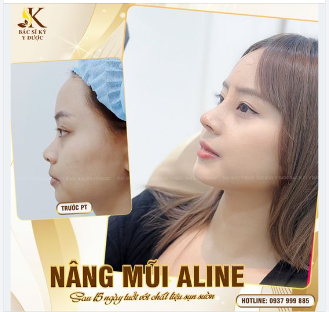 Chiêm ngưỡng dáng mũi 15 ngày tuổi tại Bác sĩ Kỳ Y Dược