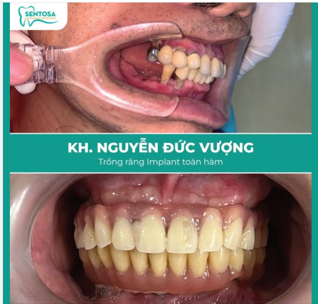Ăn ngon, sức khỏe tốt, tận hưởng niềm vui khi về già