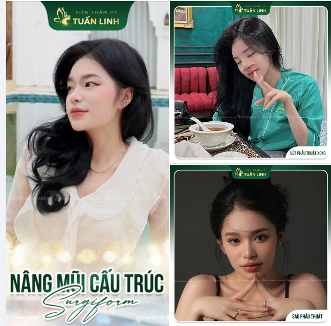 Nổi bật góc nghiêng, cân chỉnh thần thái mang đến vẻ đẹp hoàn hảo cho khách hàng!!