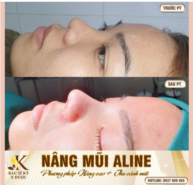 DÁNG MŨI NÀY ĐỦ KHIẾN CHỊ EM SAY ĐẮM CHƯA??