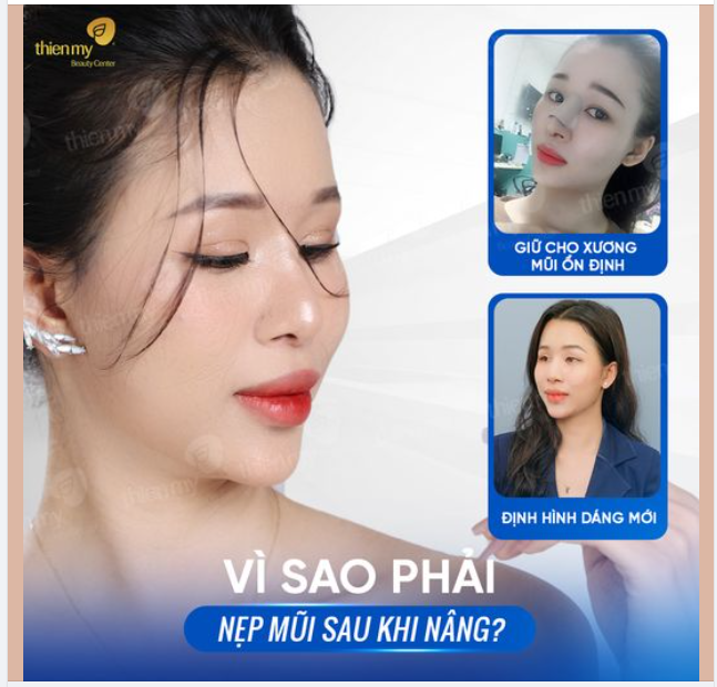 Việc cố định mũi sau khi nâng đóng vai trò quan trọng trong việc tạo nên dáng mũi hoàn hảo