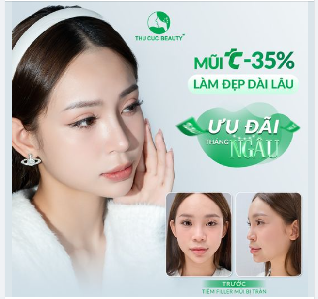 Thay đổi dáng mũi. Gương mặt tỏa sáng cùng Model Minh Hạnh