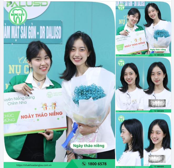 RĂNG XINH RỒI, THÁO NIỀNG THÔI!
