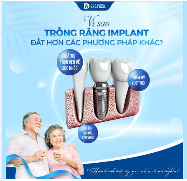 Nhiều khách hàng đến thăm khám thường thắc mắc tại sao trồng răng Implant lại có giá cao hơn các phương pháp khác, trong khi đều là răng giả.