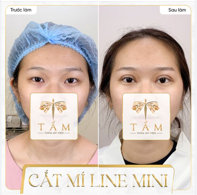 Hình ảnh chân thực của khách hàng sử dụng dịch vụ tại TMV Tấm