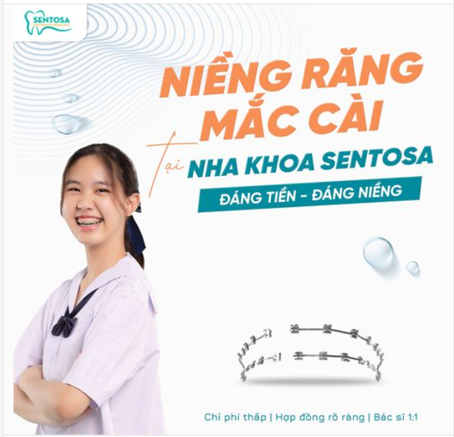 NIỀNG RĂNG MẮC CÀI: ĐÁNG TIỀN - ĐÁNG NIỀNG TẠI SENTOSA!