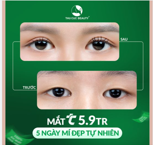 Bạn muốn sở hữu đôi mắt đẹp long lanh  Đặt lịch cắt mí ngay