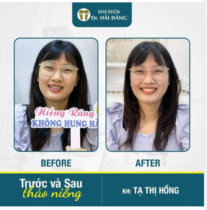 CHÚC MỪNG NGÀY THÁO NIỀNG