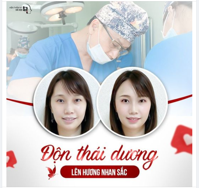 ĐỘN THÁI DƯƠNG KHUÔN TRĂNG ĐẦY ĐẶN NHƯ RẰM THÁNG 8