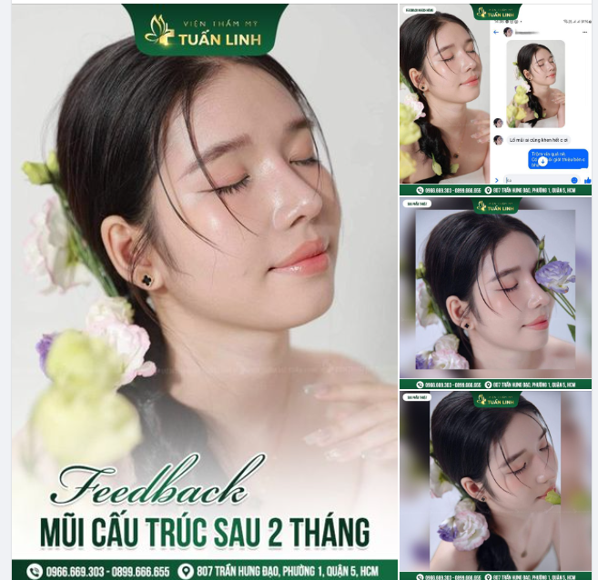"Mũi em ai gặp cũng khen hết chị ơi" Chiếc feedback siêu đáng yêu của khách hàng nhà Tuấn Linh