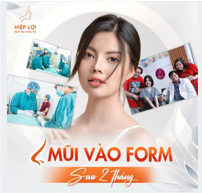 Khi nào mũi vào "FORM"?