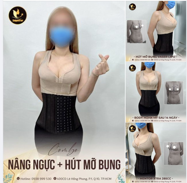 COMBO NÂNG NGỰC KHÔNG CHẠM + HÚT MỠ VASER LIPO KIẾN TẠO BODY - TỰ TIN KHOE DÁNG