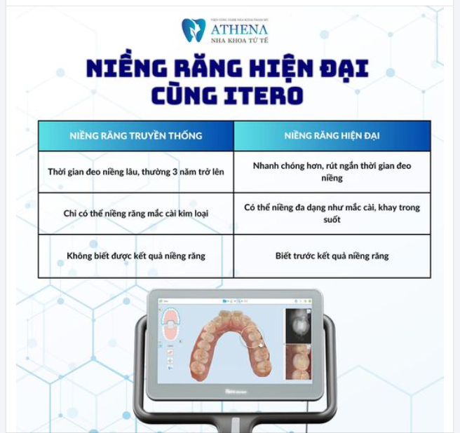 Bạn muốn tăng tốc quá trình chỉnh nha một cách hiệu quả nhất? Đừng bỏ lỡ cơ hội trải nghiệm công nghệ hàng đầu thế giới - Scan 3D Itero, giải pháp hoàn hảo tại Nha Khoa Athena:
