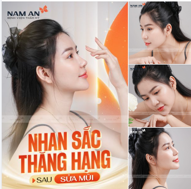 KHẮC PHỤC MŨI HỎNG ​​​​​​​ THĂNG HẠNG NHAN SẮC