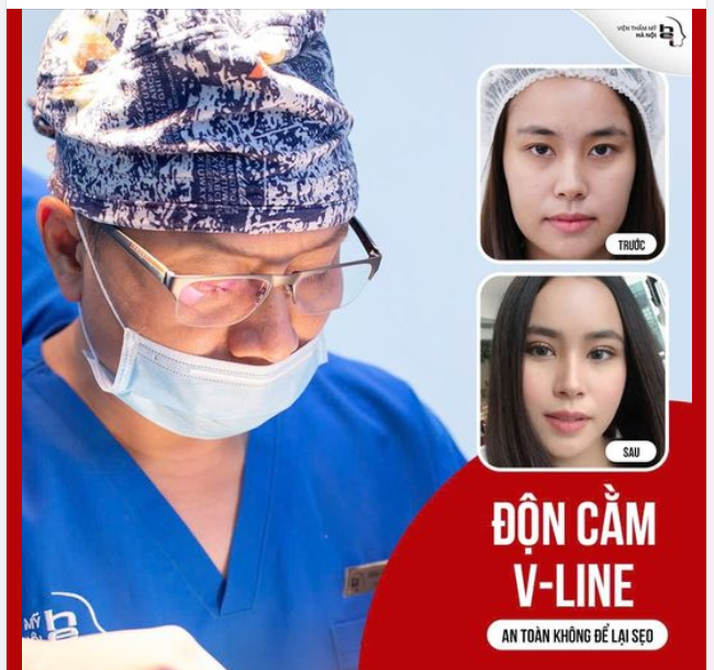 ĐỘN CẰM VLINE sở hữu CHIẾC CẰM HOÀN HẢO một cách AN TOÀN TUYỆT ĐỐI