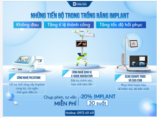 Trồng răng Implant nhanh chóng, không đau với công nghệ hiện đại