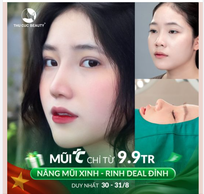 Chiếc mũi đẹp mà ai cũng muốn