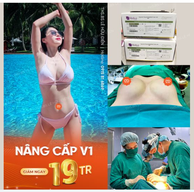 NÂNG CẤP V1 GIẢM NGAY 19TR
