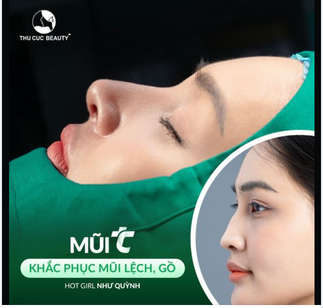 Nâng mũi đang được giảm sâu 35%. Chị em đã biết chưa ??