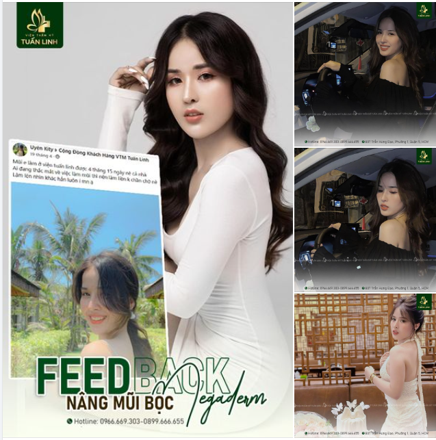 Feedback nâng mũi từ 100% khách hàng thật 